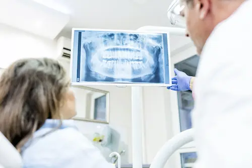 Digital Dental X-Rays available at Cleveland Family Dental in Cleveland, TX